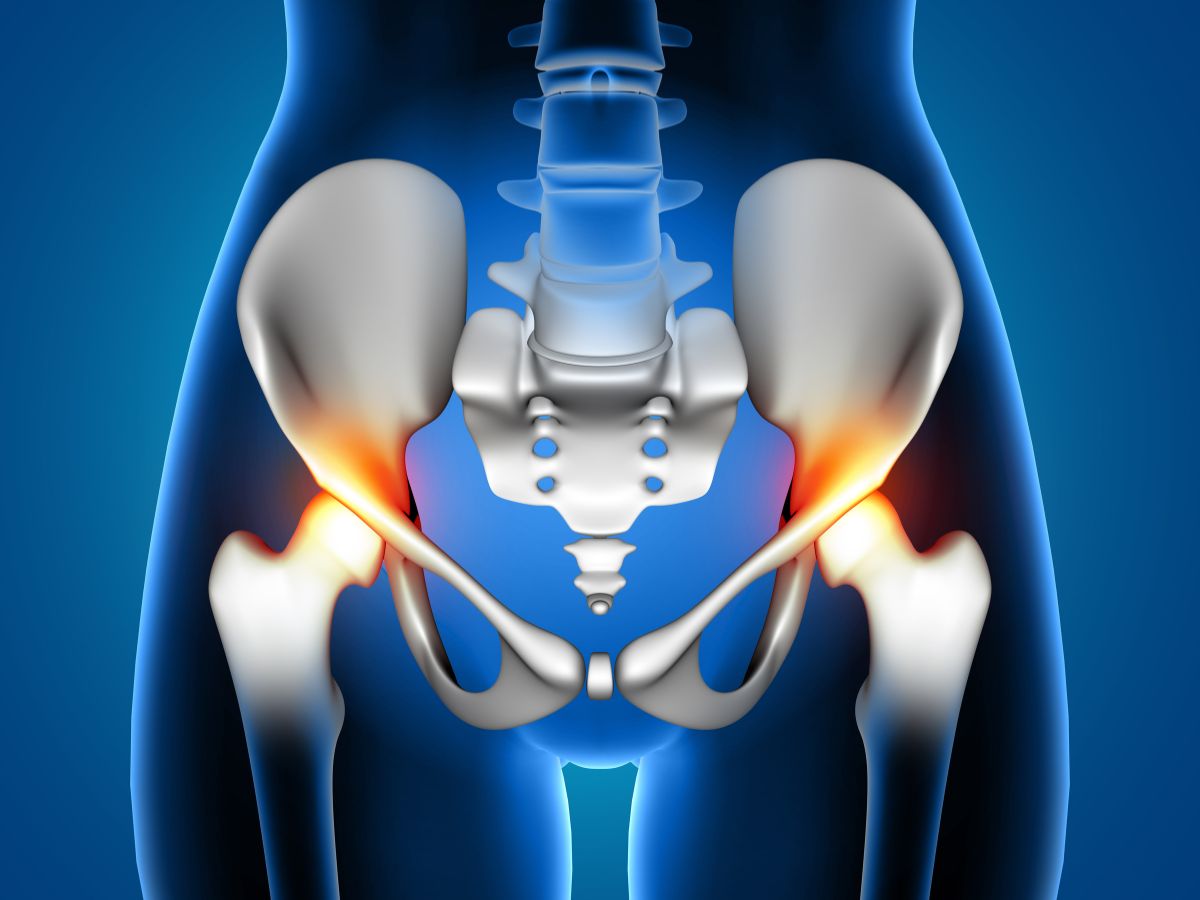 total hip replacement surgery causes procedure recovery guide