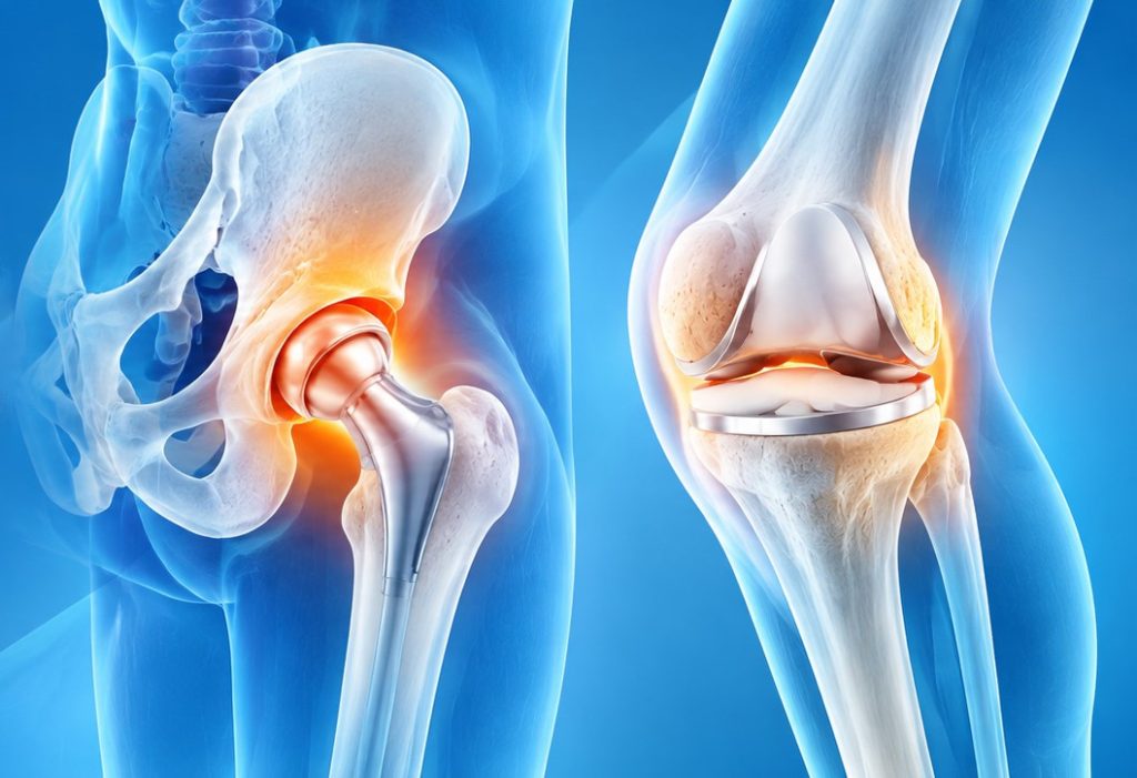 knee and hip pain treatment in ahmedabad
