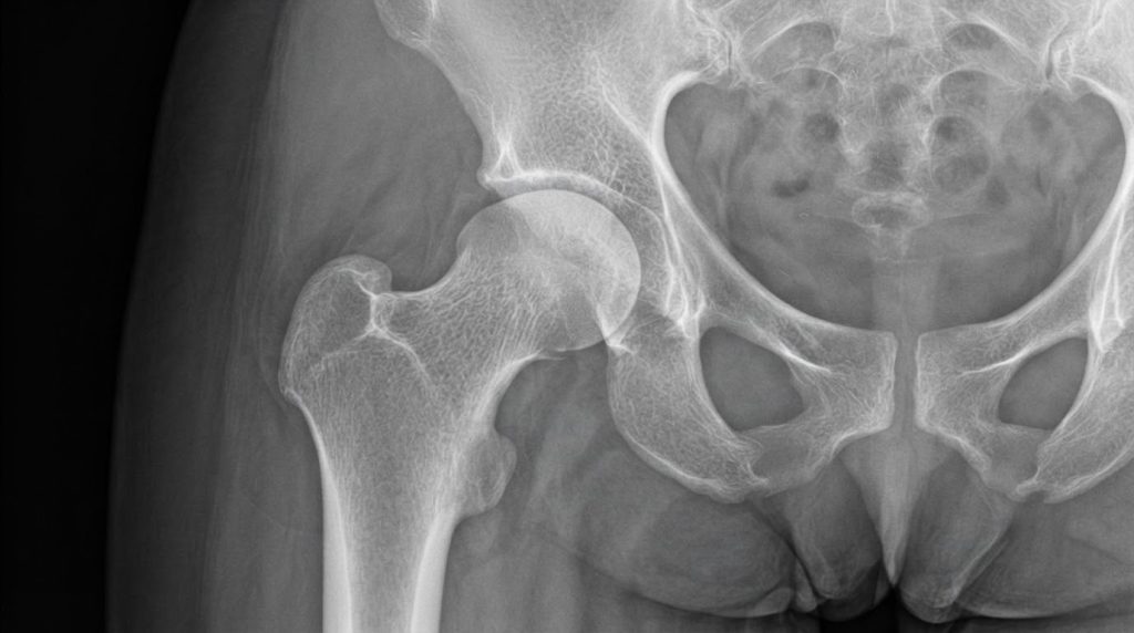 best hip replacement surgeon in ahmedabad (2)